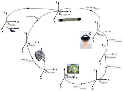 Development and Application of Digital Maxillofacial Surgery System Based on Mixed Reality Technology